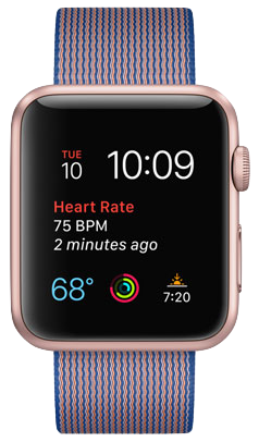Apple Watch Series 1 – 38 vagy 42 mm-es tokméret